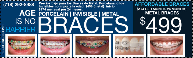 BRACES $499